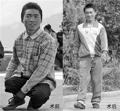 大山村小 那个曾爬着上学的少年重回母校