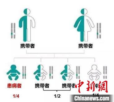 专家：罕见病并不“无计可施”积极预防是关键