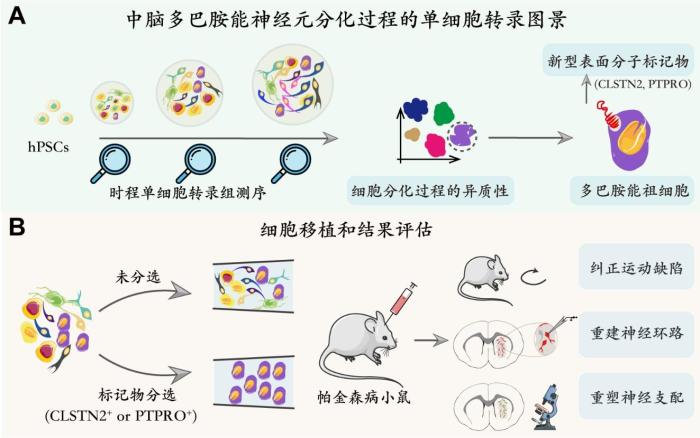 推动帕金森病治疗新研究有助预测细胞替代疗法结果