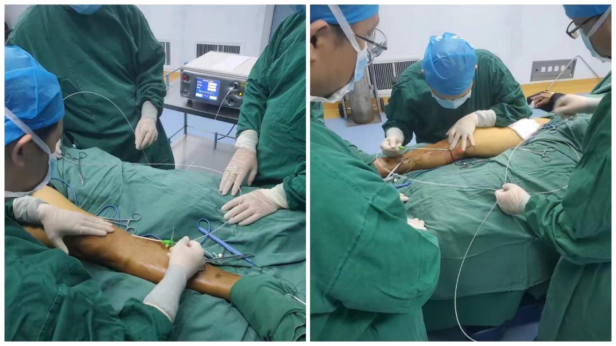 市四院普外科技术新进展